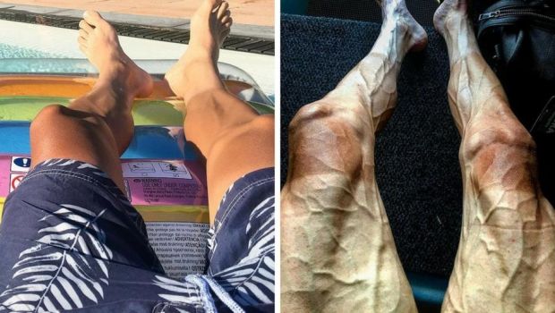 Naziv: sp-pre-posle.jpg, pregleda: 212, veličina: 48,7 KB